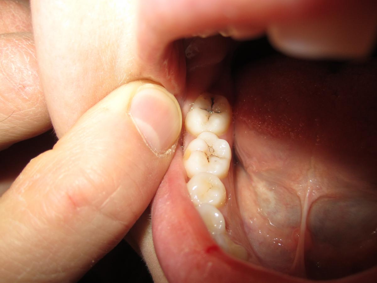 Тест проблем полости рта