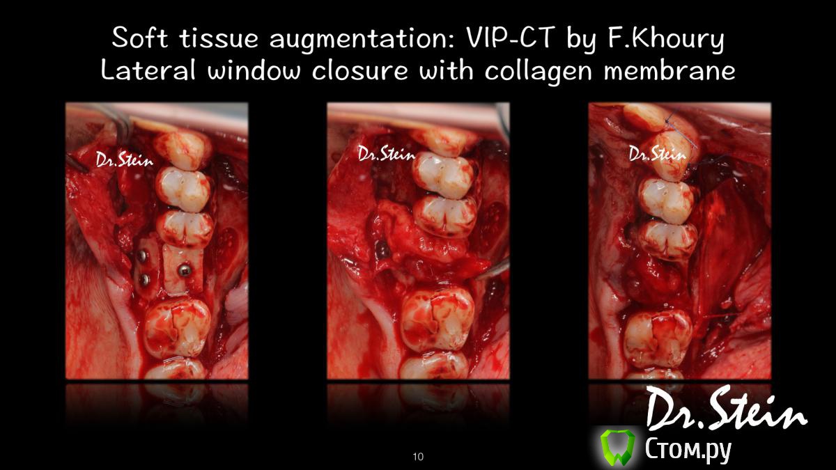 post-36969-0-12508700-1390775263_thumb.j