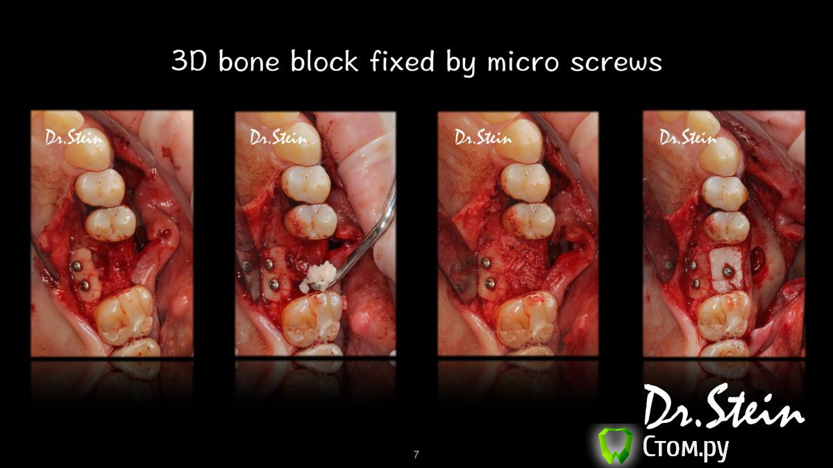 post-36969-0-13615000-1390775223_thumb.j