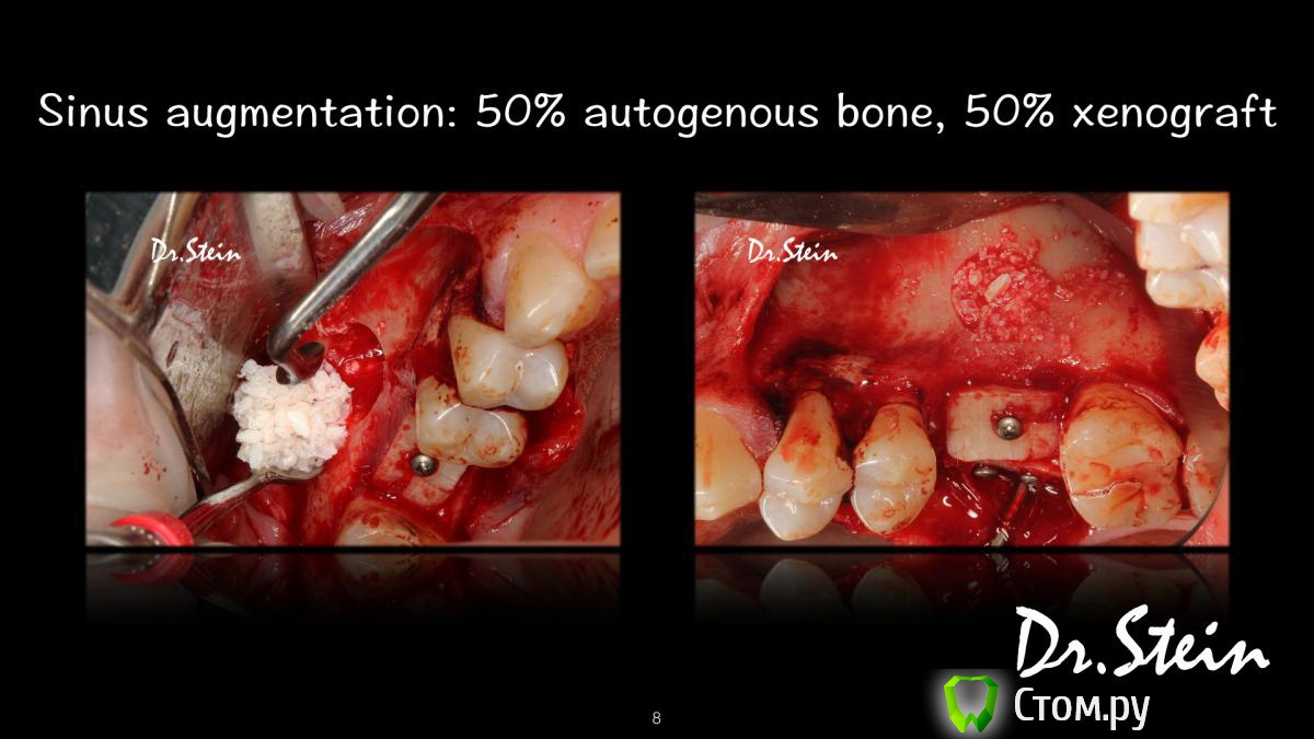 post-36969-0-27339200-1390775234_thumb.j