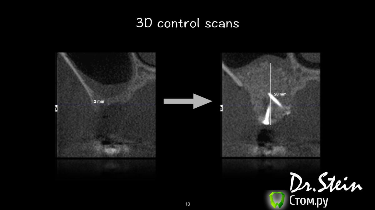 post-36969-0-37144400-1390775496_thumb.j
