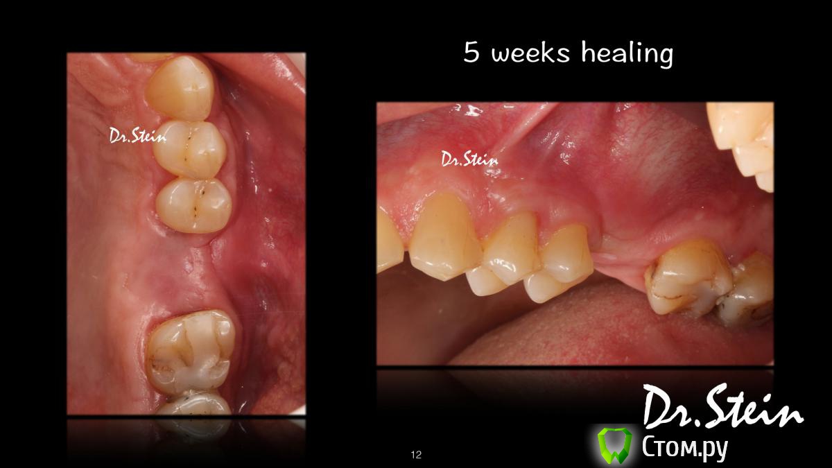 post-36969-0-39315900-1390775492_thumb.j