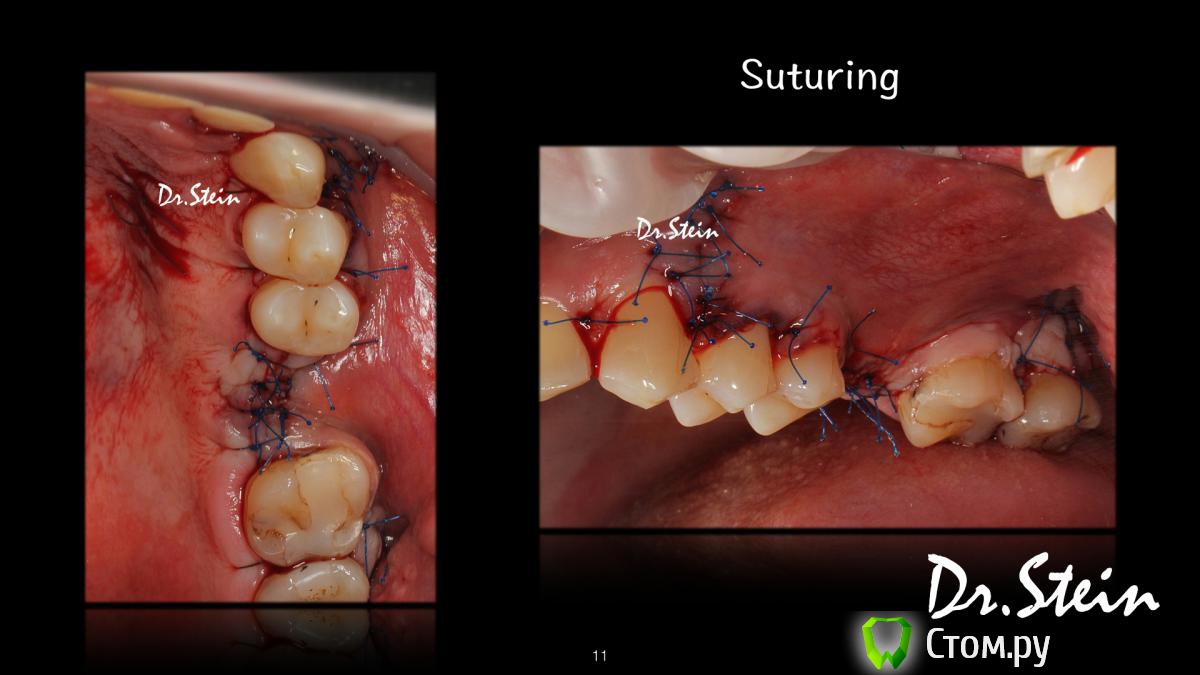 post-36969-0-39456900-1390775482_thumb.j