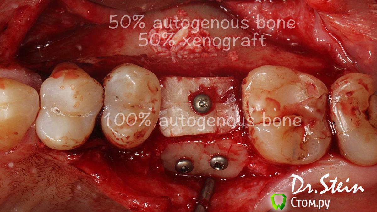 post-36969-0-60792200-1390775252_thumb.j