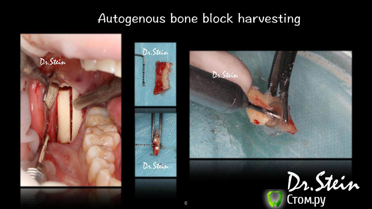 post-36969-0-61518500-1390775212_thumb.j