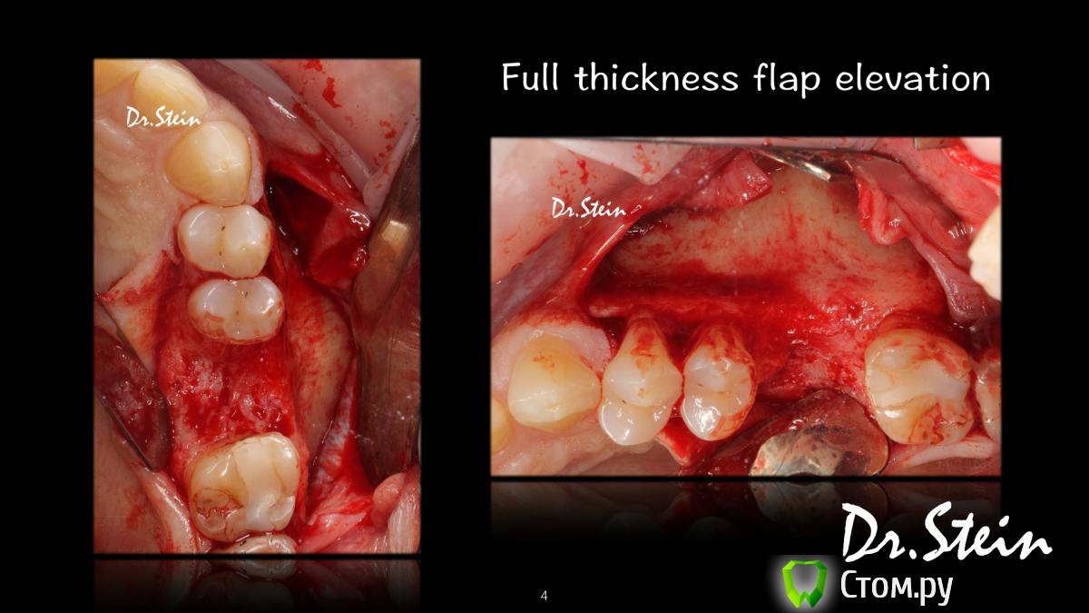 post-36969-0-75418200-1390775190_thumb.j