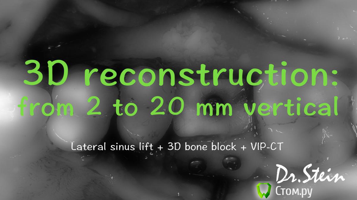 post-36969-0-79384200-1390775162_thumb.j