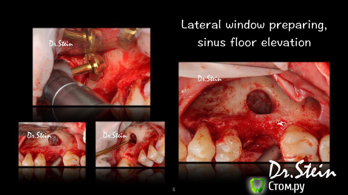 post-36969-0-84150900-1390775201_thumb.j