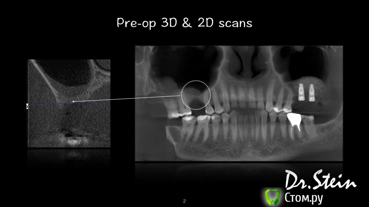 post-36969-0-86242300-1390775168_thumb.j