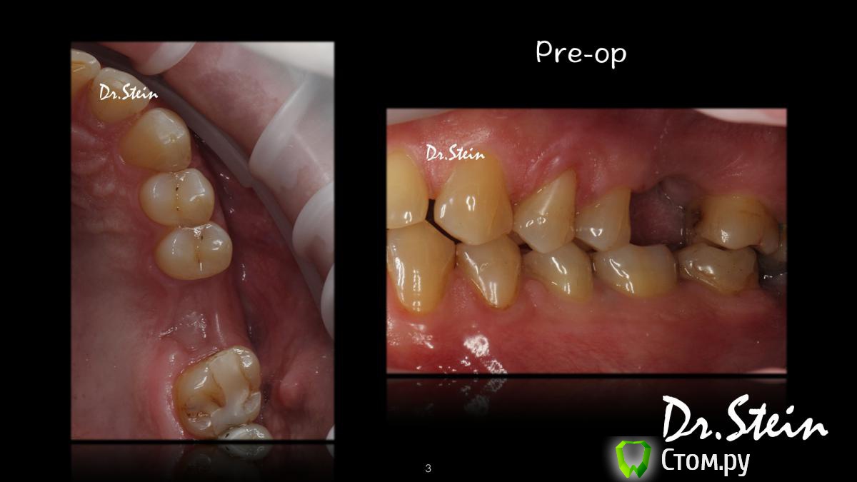 post-36969-0-90405300-1390775178_thumb.j