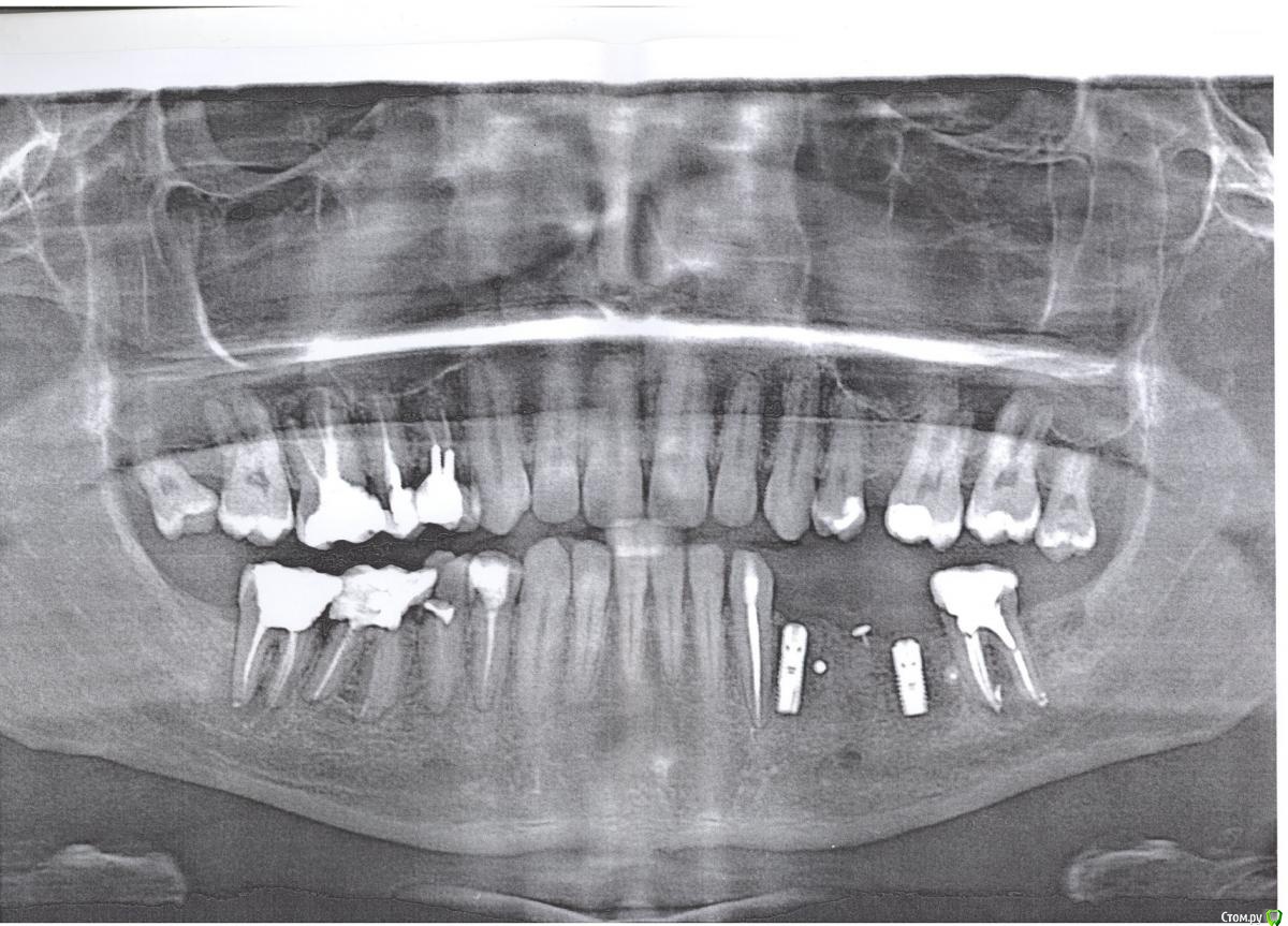 post-39428-0-98630000-1421520951_thumb.j