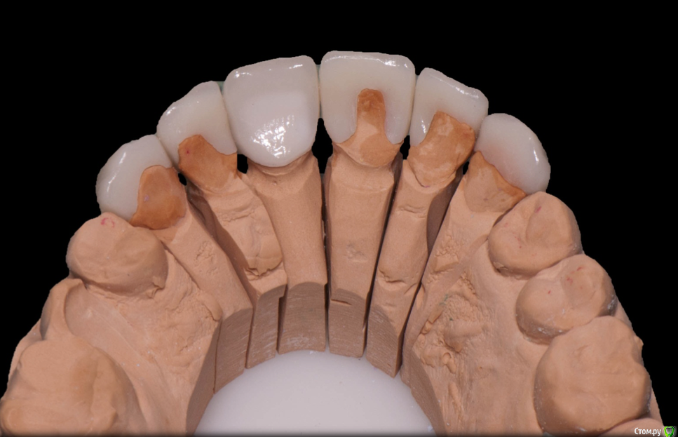 Снимок экрана 2015-03-26 в 0.56.40.png