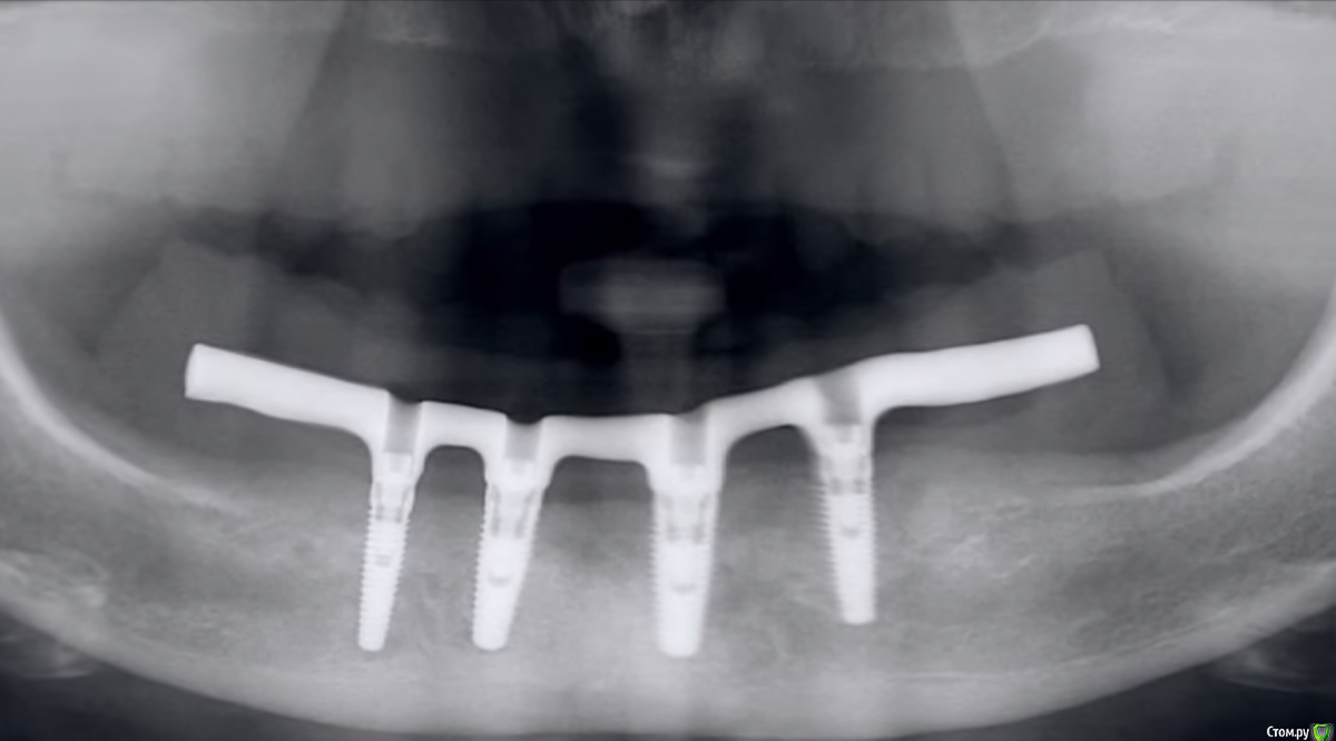 Снимок экрана 2015-04-12 в 22.03.47.png