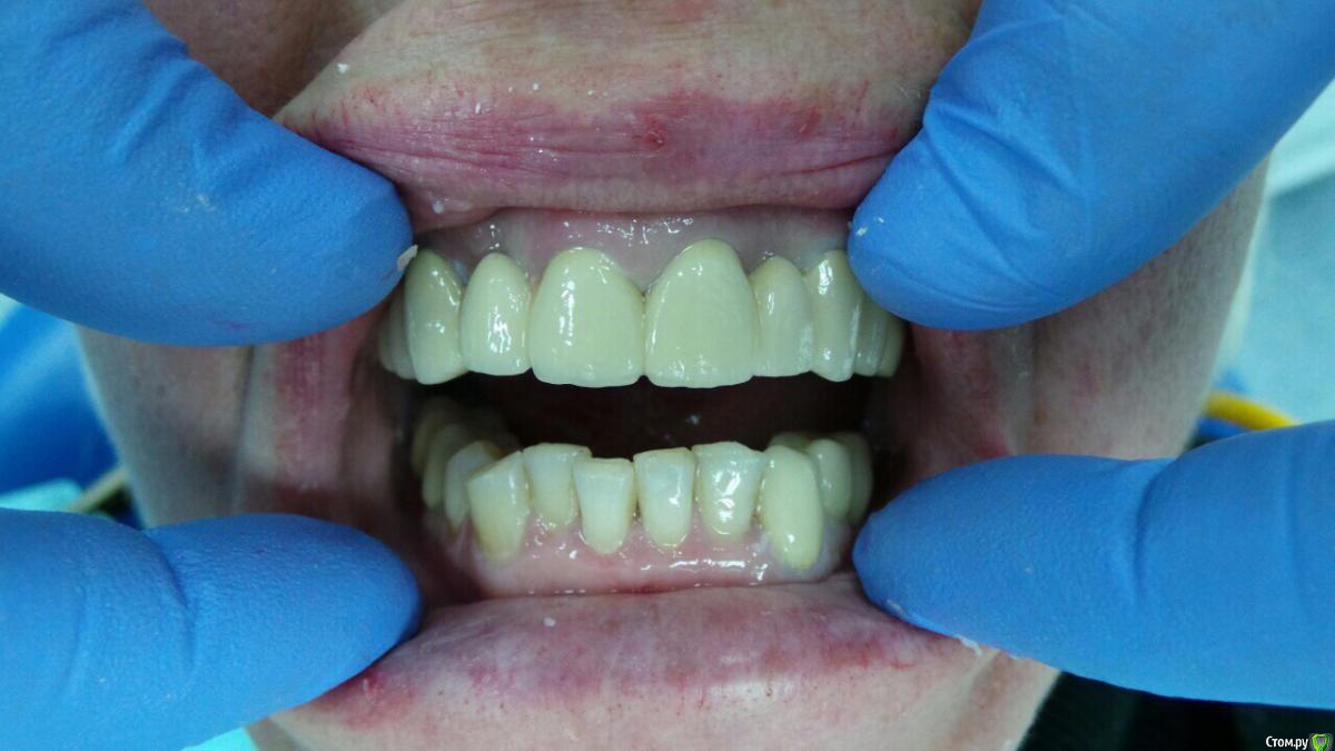 post-46976-0-31270500-1459521200_thumb.j