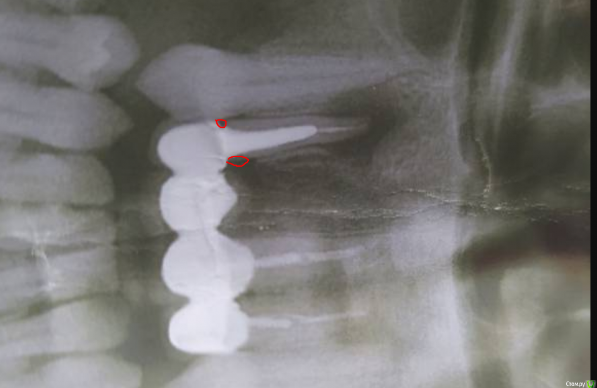 post-58911-0-20239100-1586876866_thumb.p