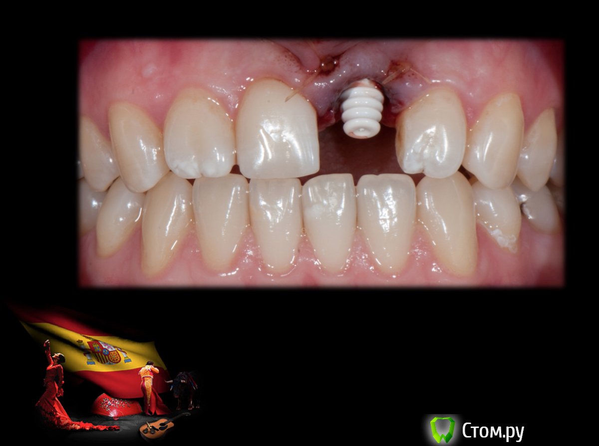 Screen Shot 2014-05-18 at 22.07.45.png