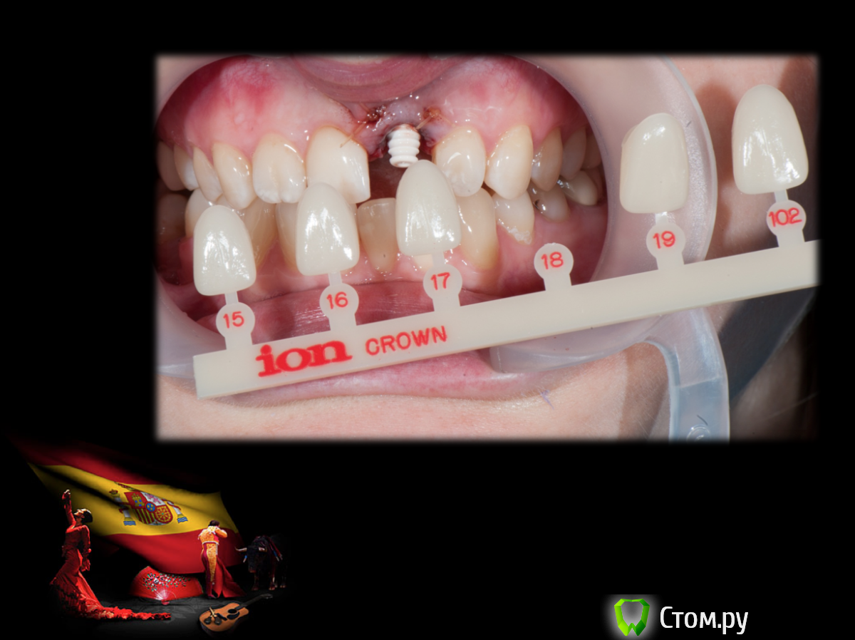 Screen Shot 2014-05-18 at 22.08.10.png