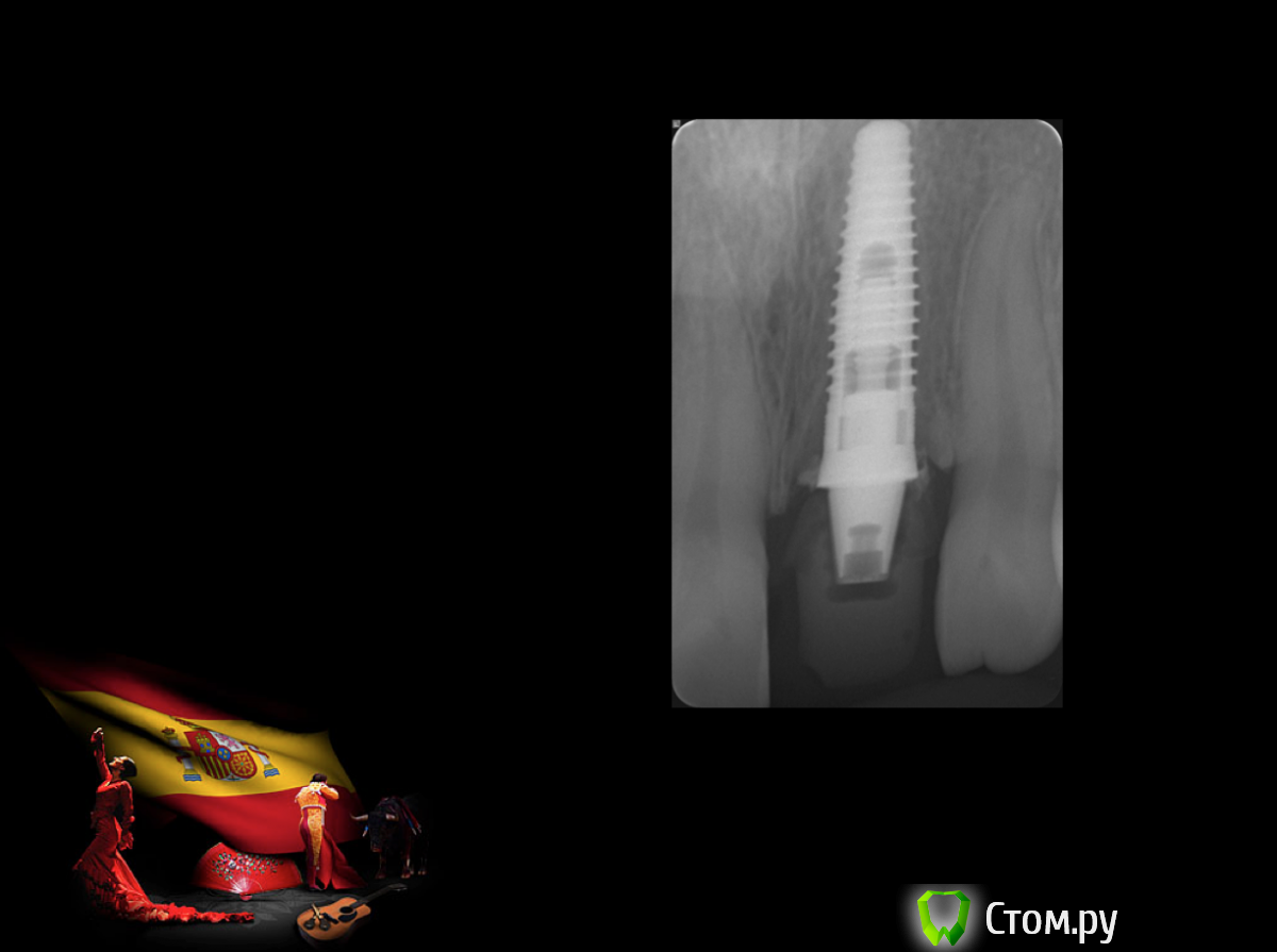 Screen Shot 2014-05-18 at 22.10.01.png