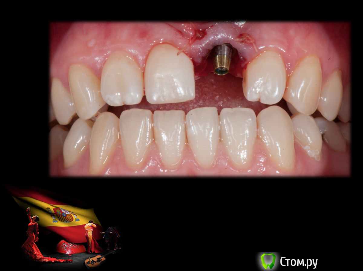 Screen Shot 2014-05-22 at 22.04.07.png