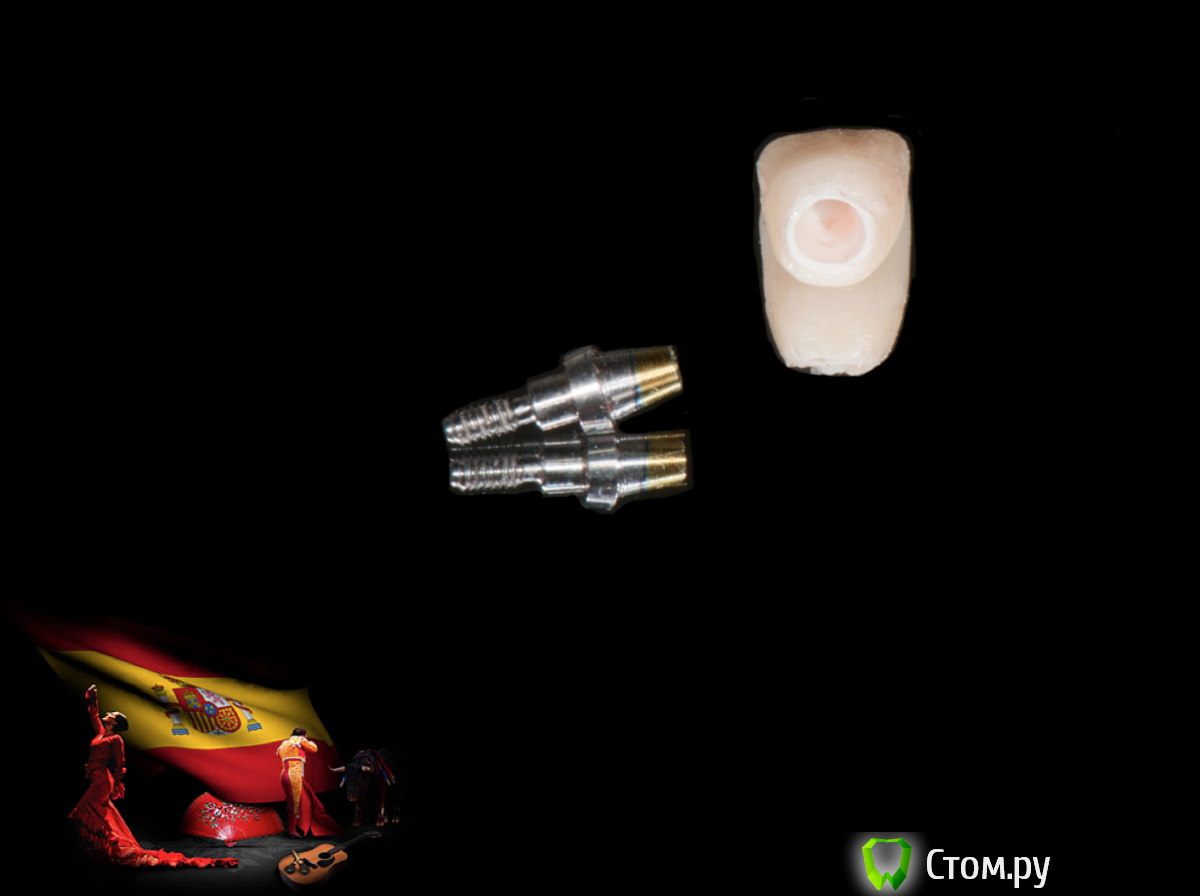 Screen Shot 2014-05-18 at 22.08.38.png