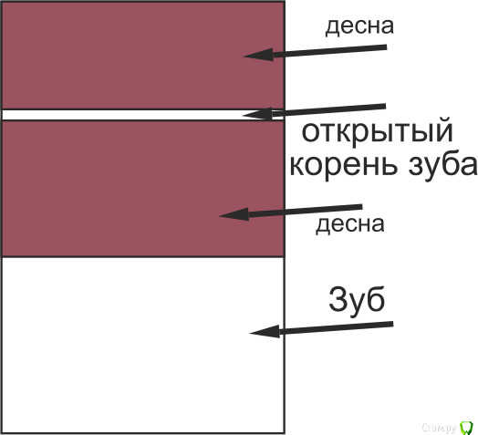 Рекомендации после операции на десне