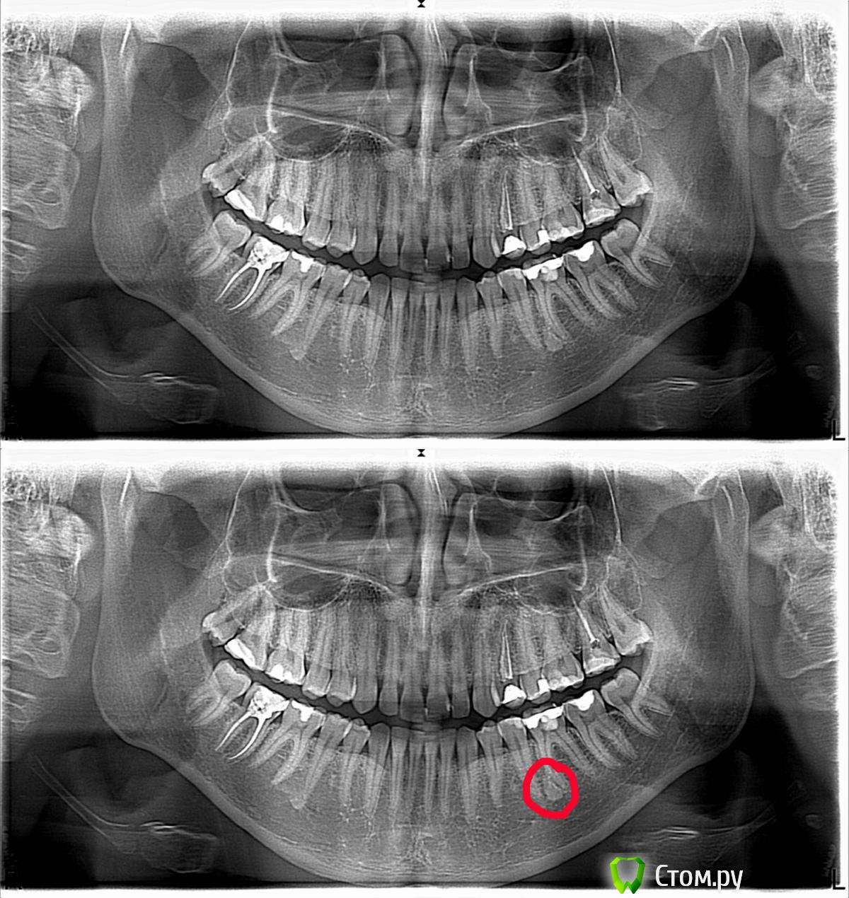 post-39032-0-14469900-1401716066_thumb.j