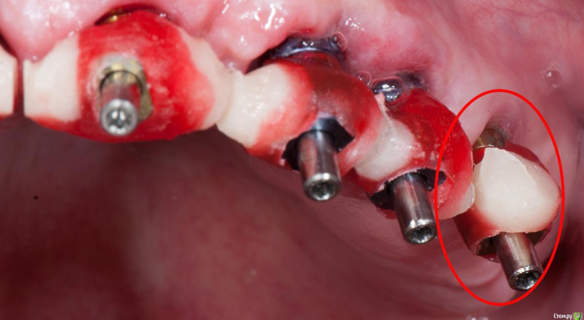 DSC_0919 копия.jpg