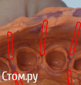 post-37675-0-17837900-1406315451_thumb.j