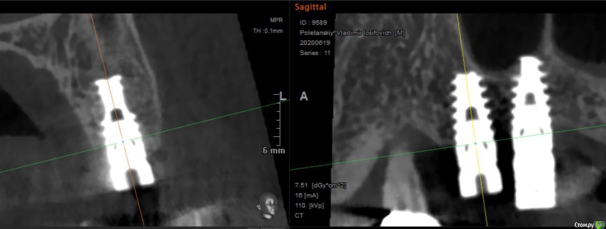 post-55199-0-92507400-1594194279_thumb.j