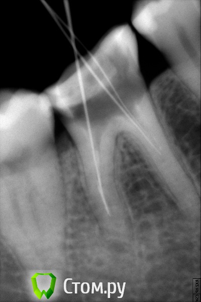 post-18593-0-35708800-1409383208_thumb.j