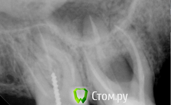 post-18593-0-80578500-1410596555_thumb.j