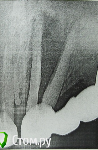 post-18593-0-80752100-1409769459_thumb.j