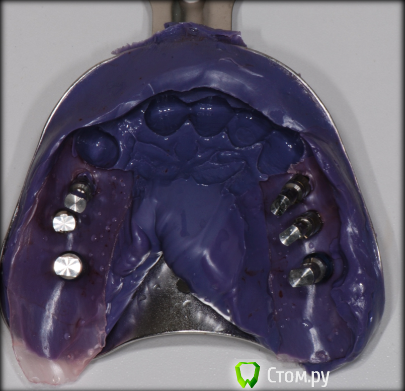 Снимок экрана 2014-09-23 в 20.23.11.png