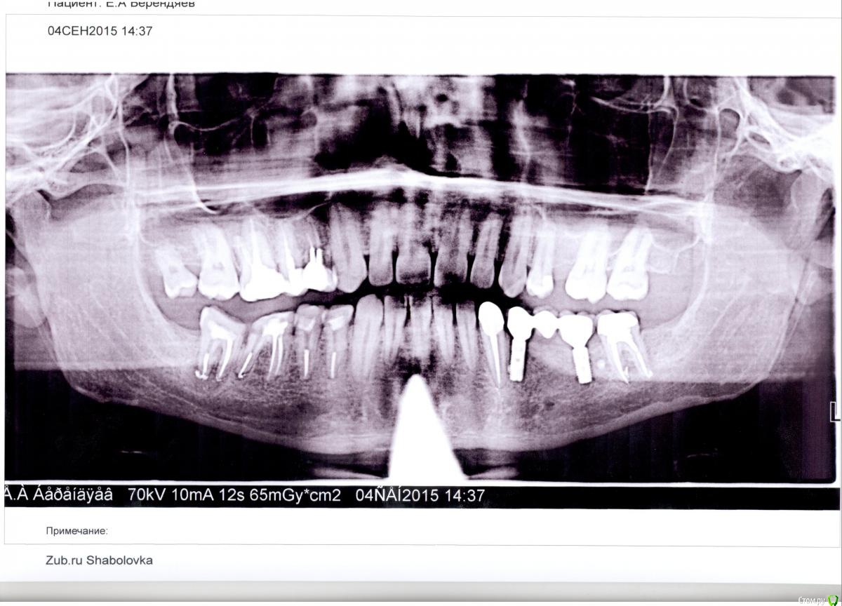 post-39428-0-45755200-1441367820_thumb.j