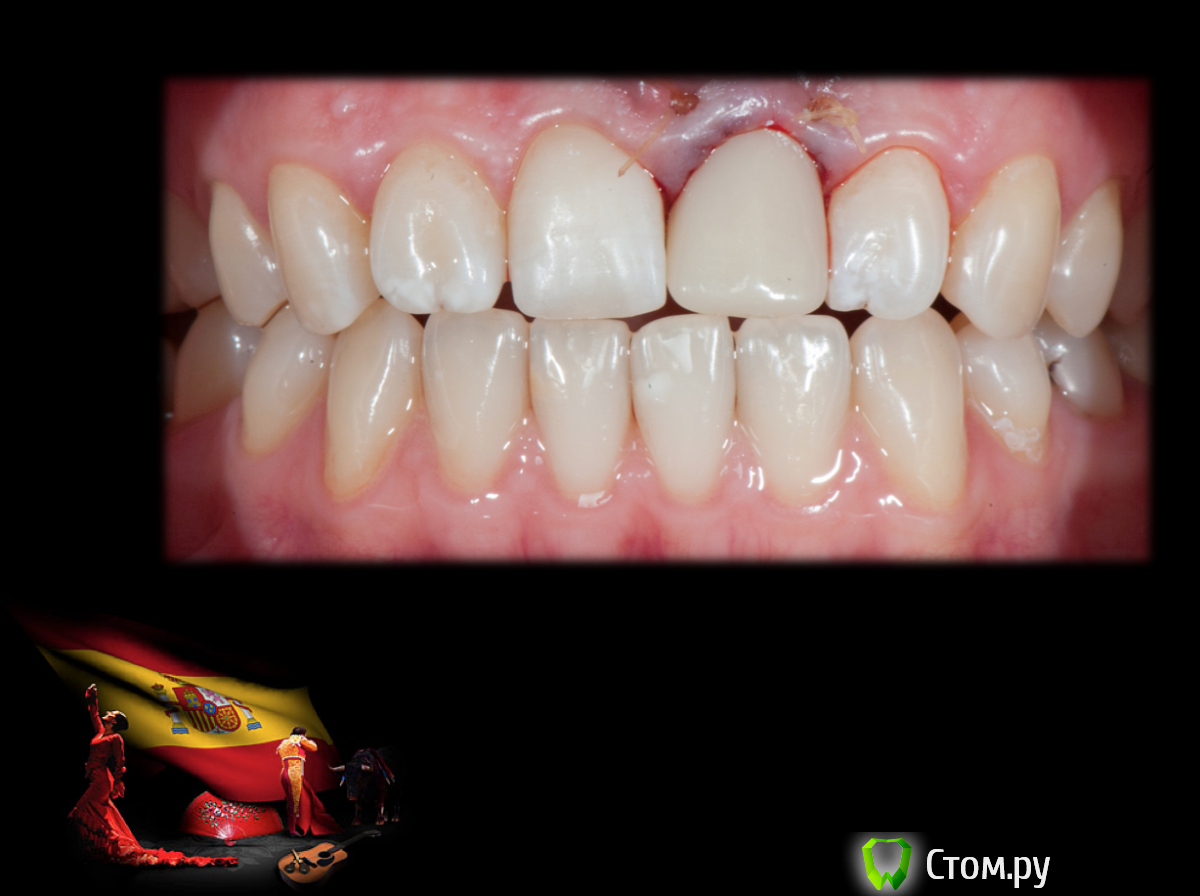 Screen Shot 2014-05-18 at 22.09.40.png