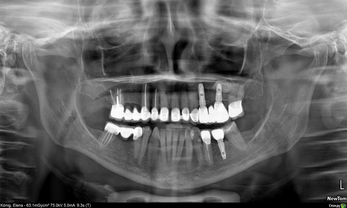 Какая стоматологическая клиника в Сочи на самом деле хорошая?