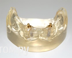 post-35344-0-48956000-1385472871_thumb.j