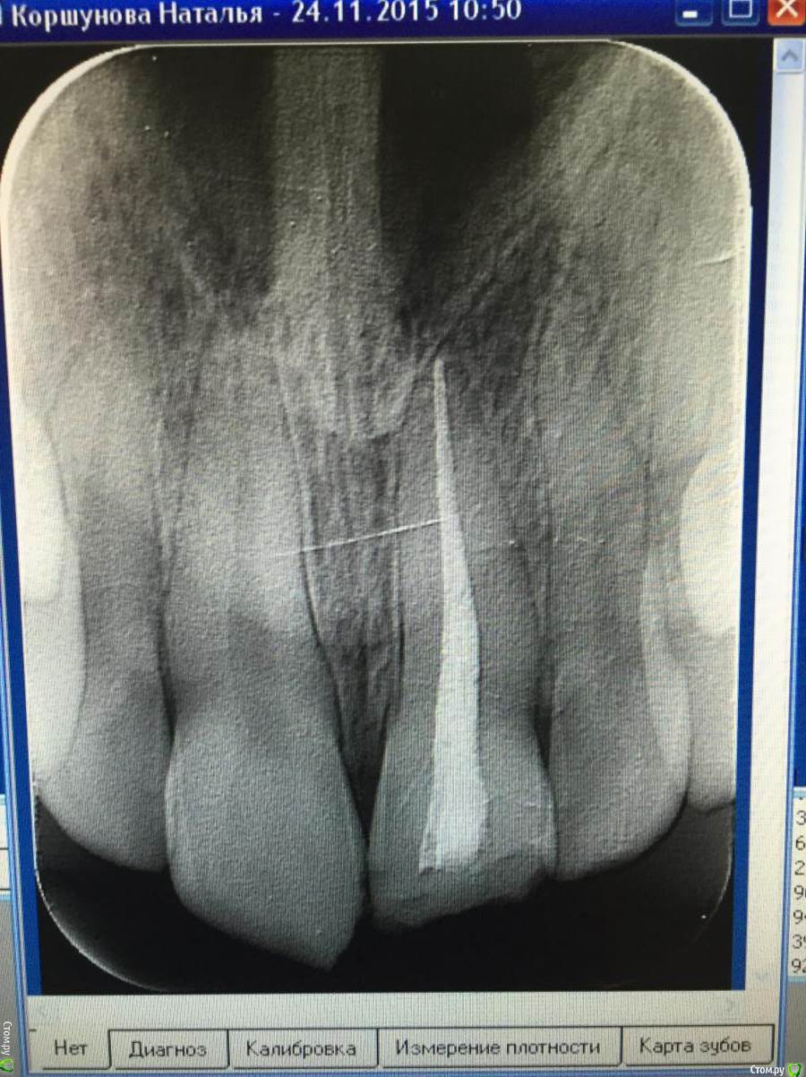 post-36193-0-60220800-1448484483_thumb.j