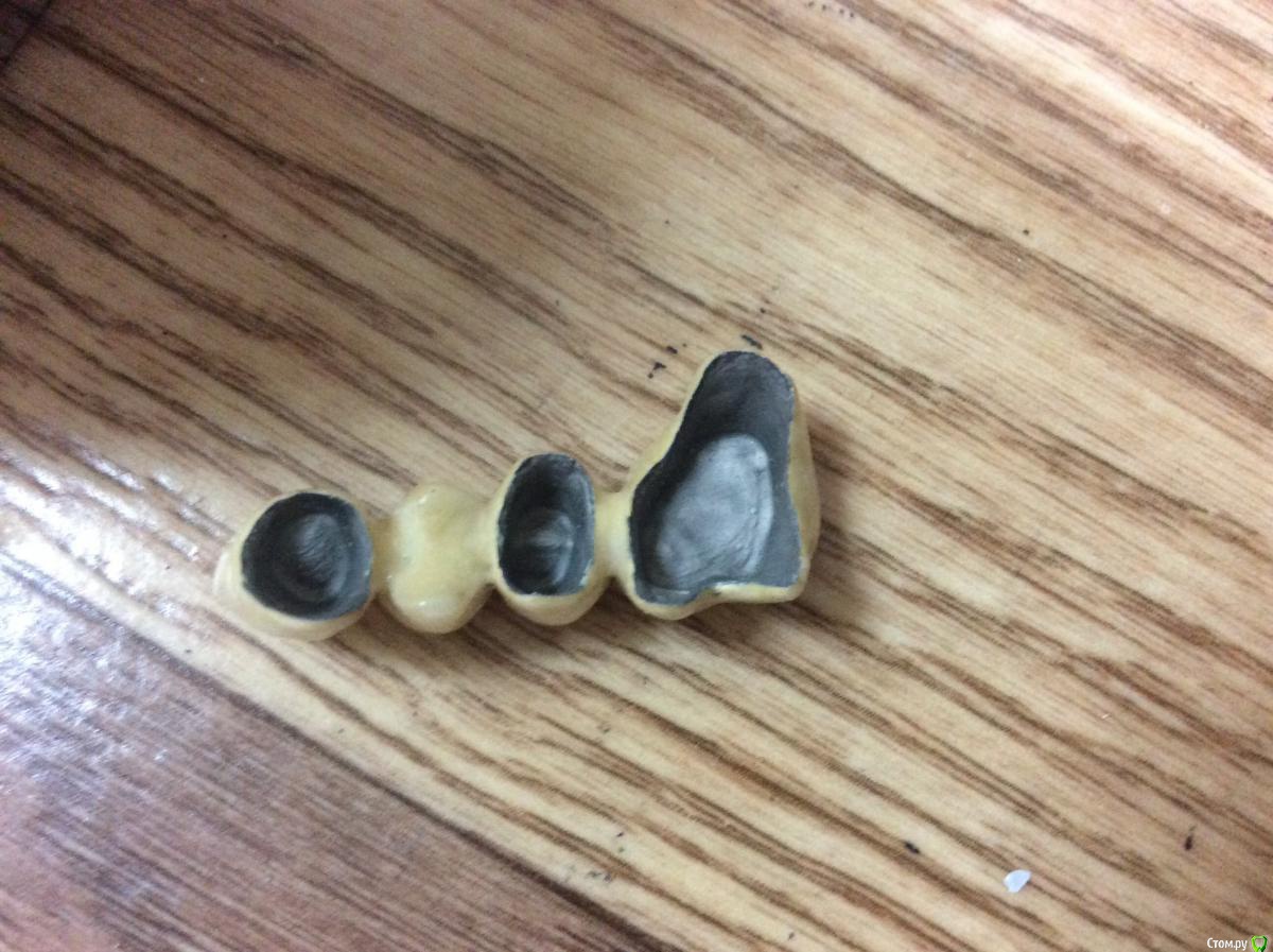 post-38027-0-27886600-1448472043_thumb.j