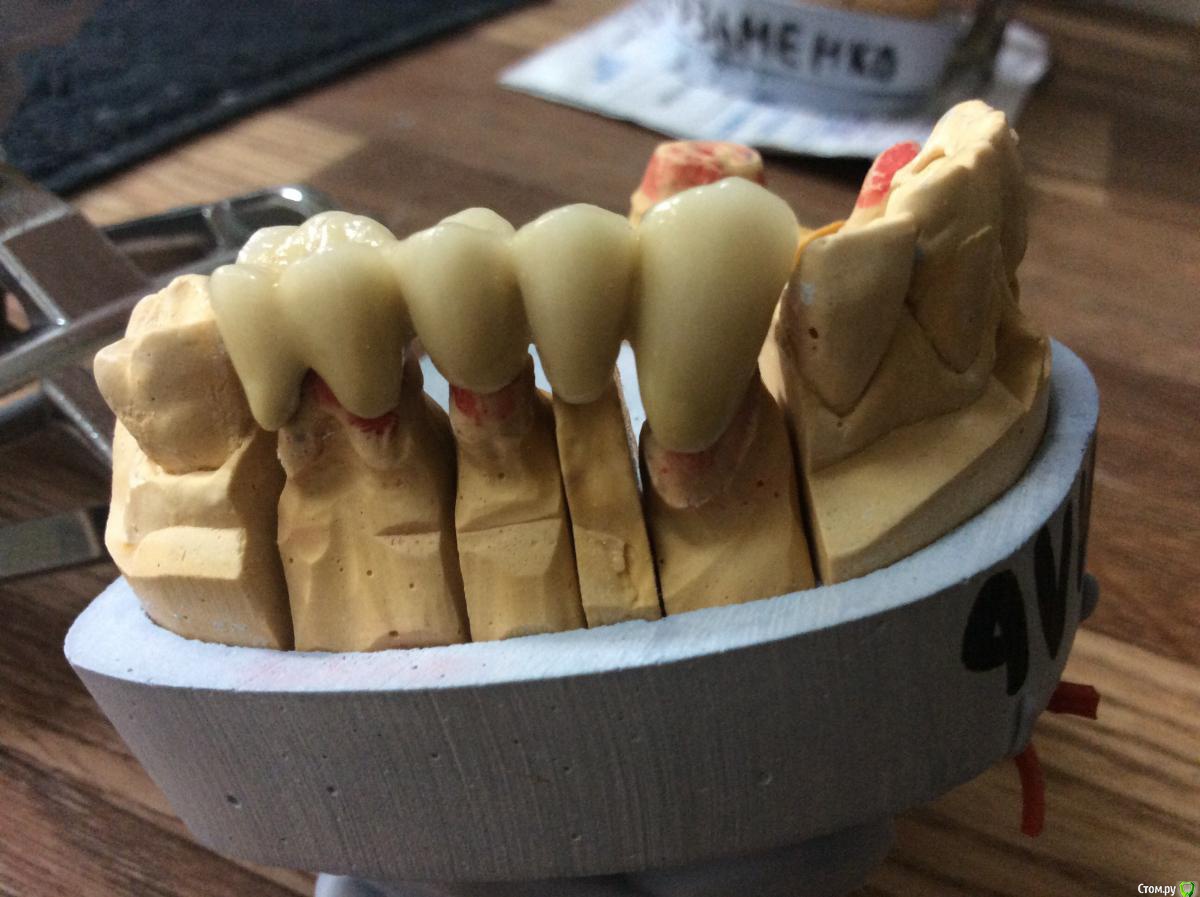 post-38027-0-43034400-1448472053_thumb.j