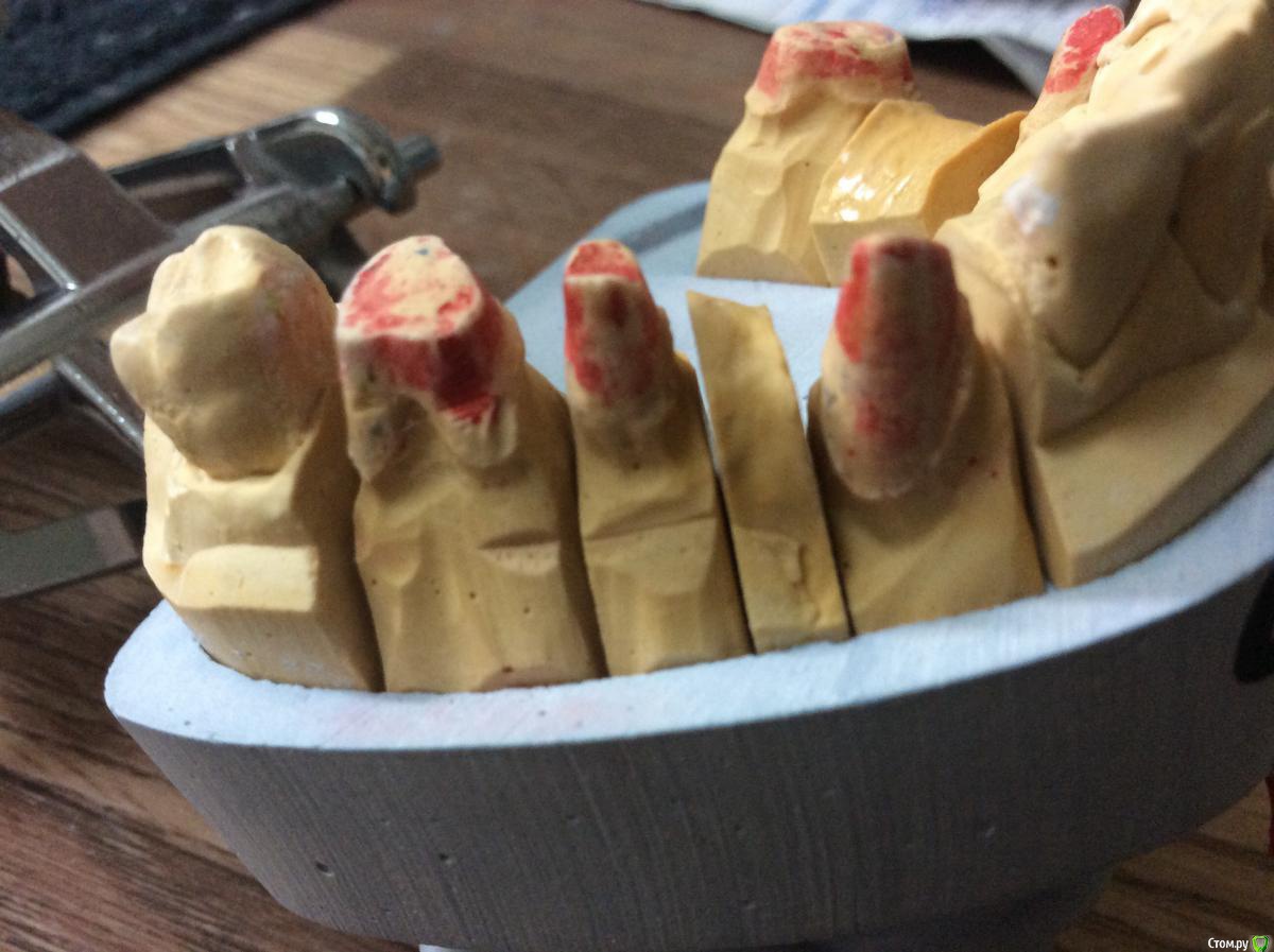 post-38027-0-46853300-1448472070_thumb.j