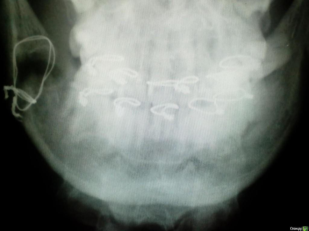 post-50052-0-11365500-1483171704_thumb.j