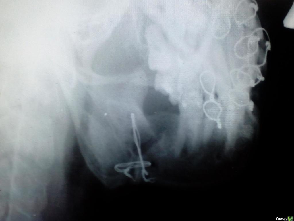 post-50052-0-43682600-1483171783_thumb.j