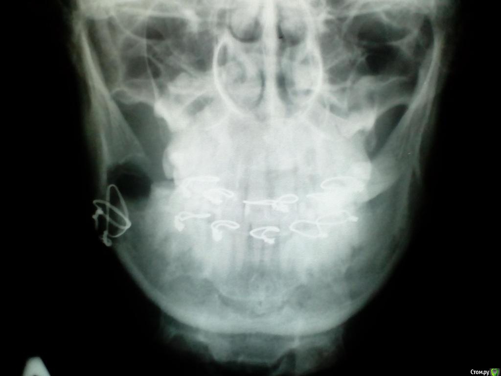 post-50052-0-53727500-1483171503_thumb.j