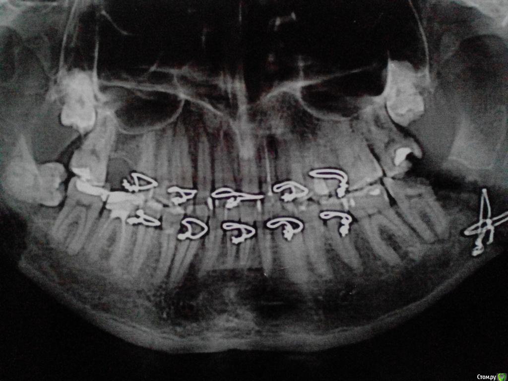 post-50052-0-70492300-1483171375_thumb.j