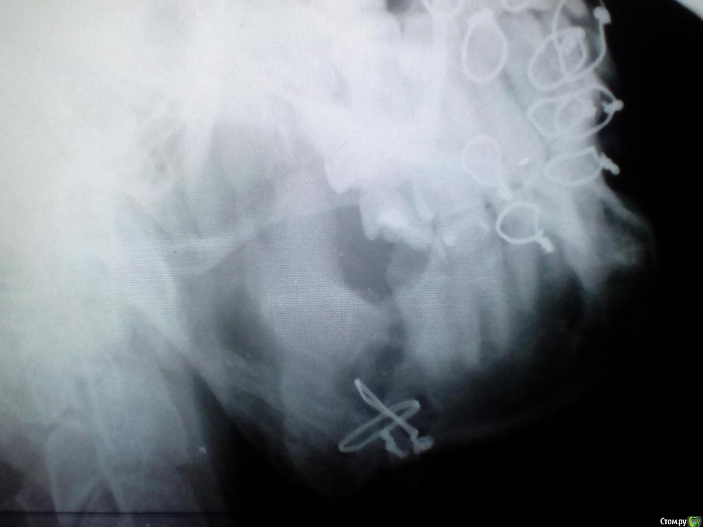 post-50052-0-91156400-1483171629_thumb.j