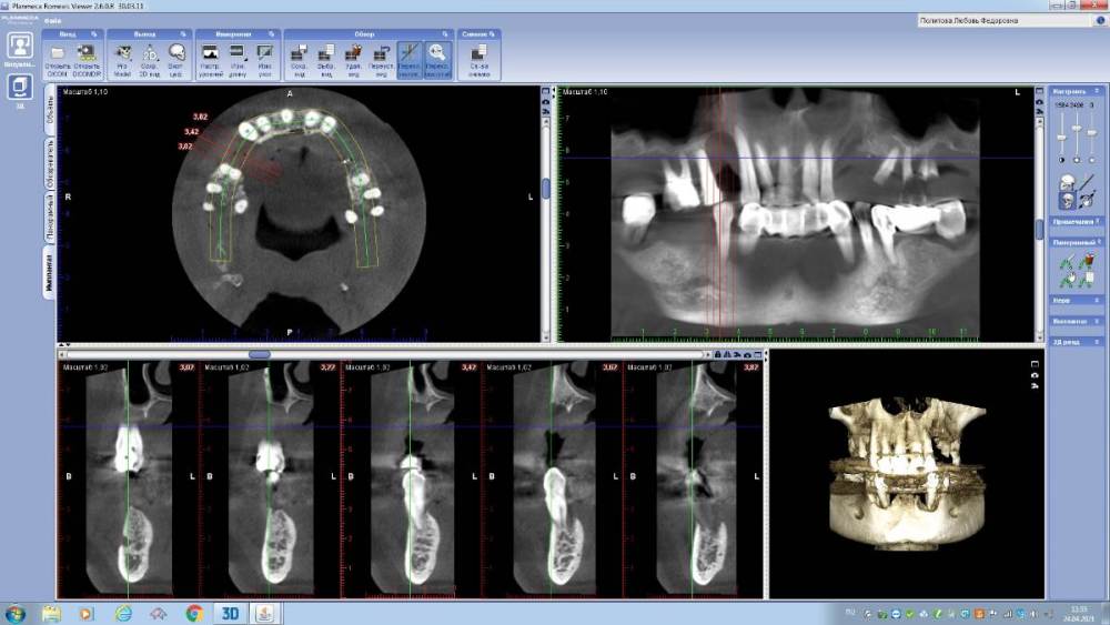 Политова до операции исходник.jpg