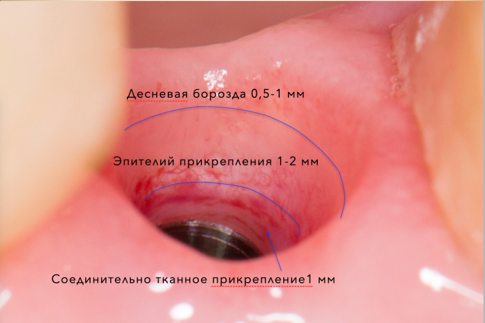 Снимок экрана 2021-04-01 в 16.28.11.png