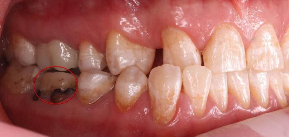 Роман Р. М. от 02.02.2021 0 00 00 1 и 4 сегмент-1.jpg