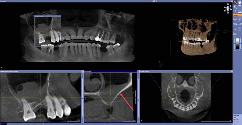 для форума.jpg